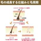 神奈川県横浜市の脱毛ならレディース脱毛・メンズ脱毛＆エステスパClean Kingがおすすめ